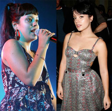 Lily Allen hypnos-bantar