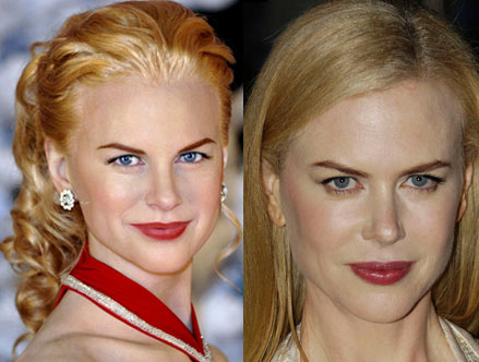 Nicole Kidman vs vaxdocka?