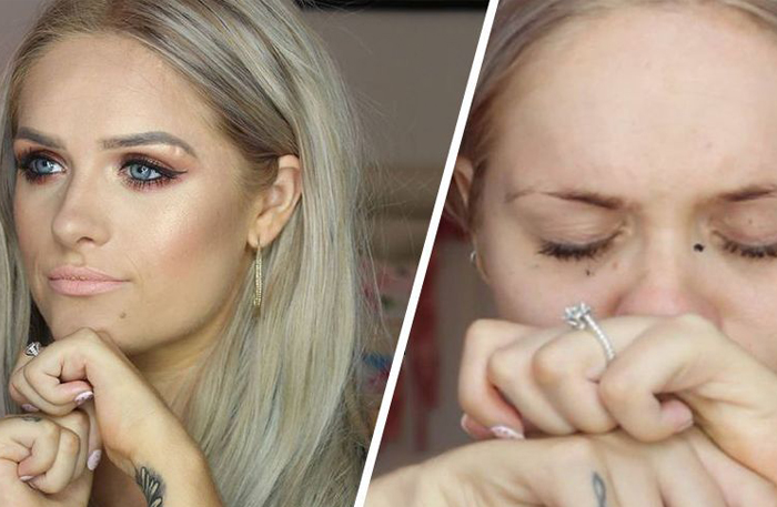 Beautybloggarens avslöjande berör tusentals – se hennes viktiga budskap