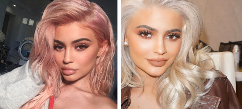 kylie jenner lips