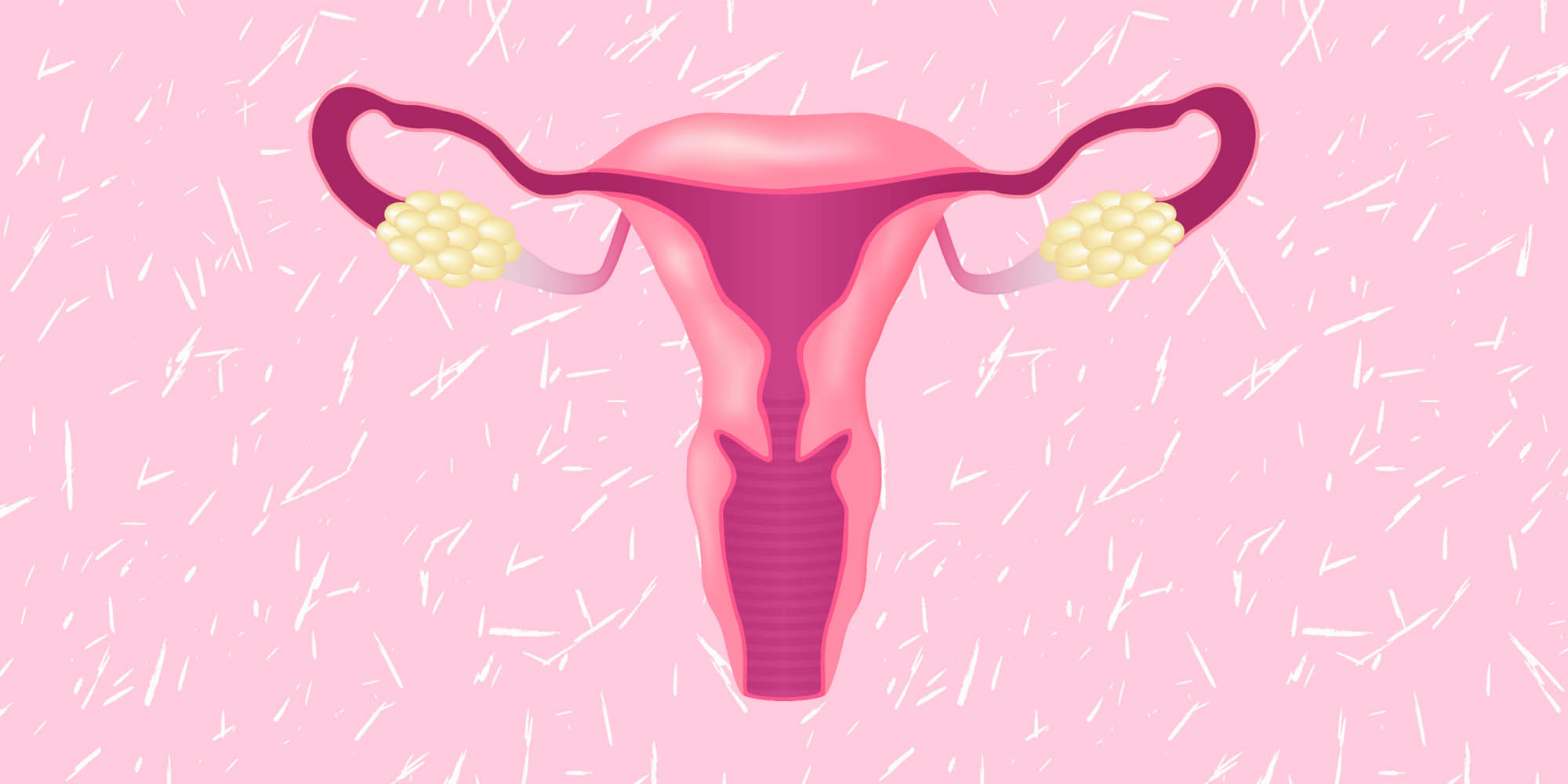 Fler drabbas av livmoderhalscancer – ingen vet varför