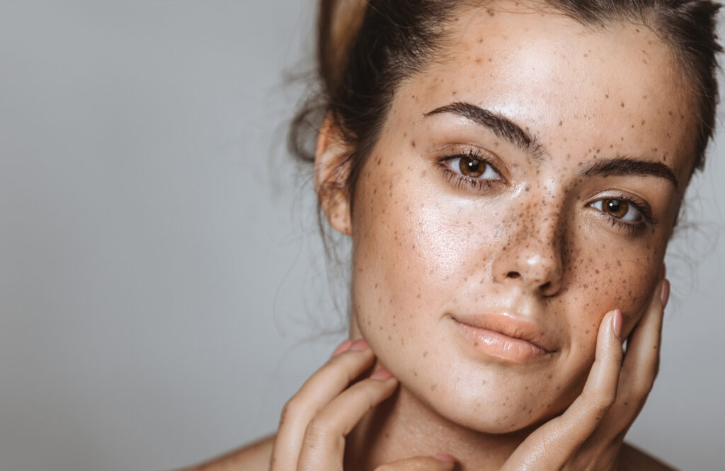 Sheet mask