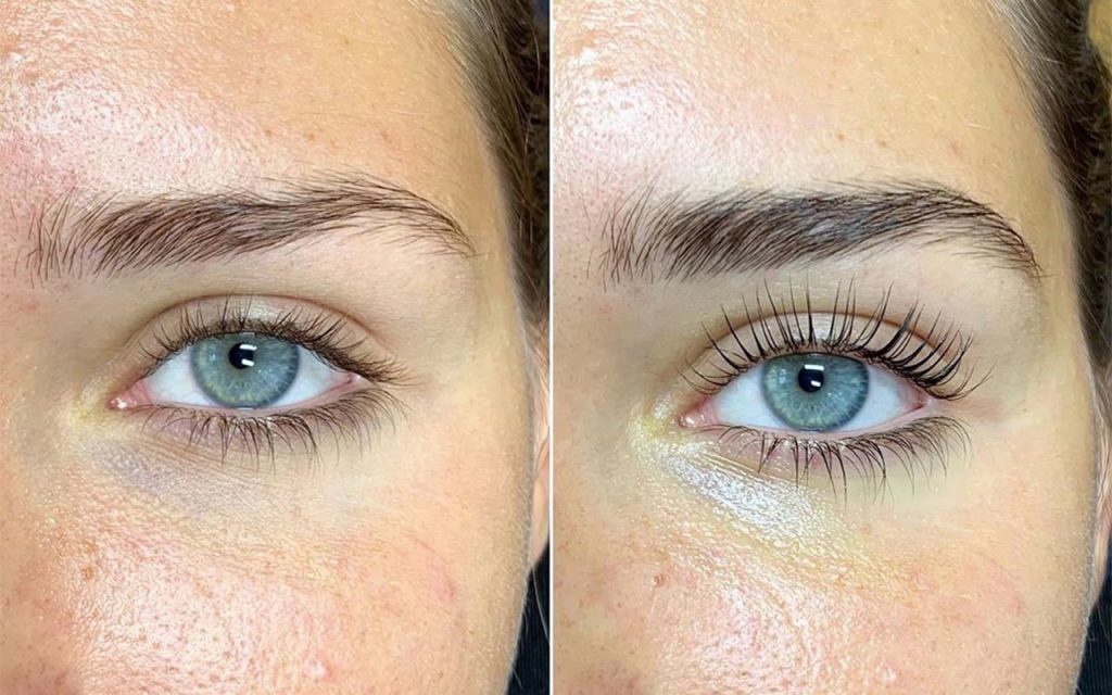 Vad är lash lift? 
