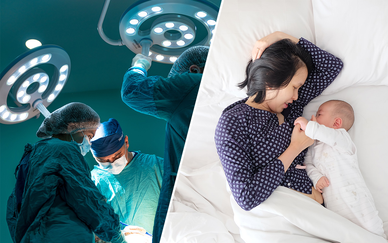 Förlossningskrisen: hälften av anmälda förlossningsskador hade kunnat förebyggas