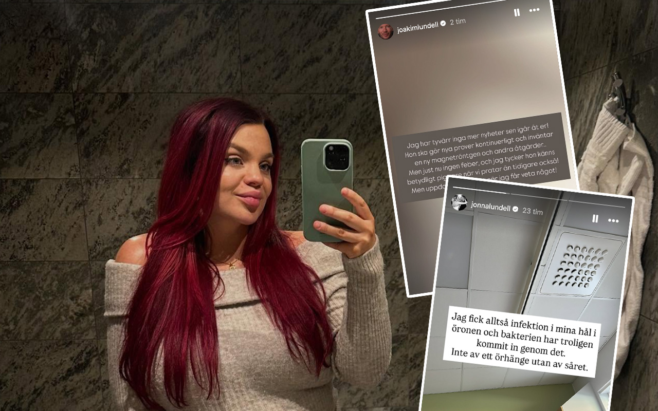 Jonna Lundell har fått sepsis – 7 symtom du måste känna till